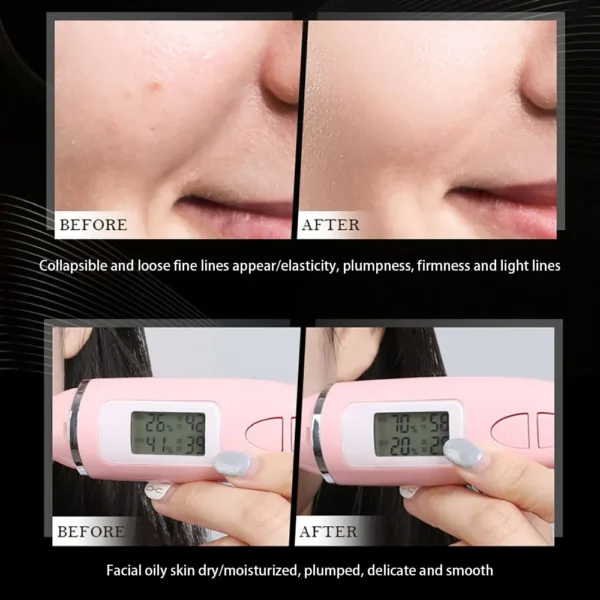 Creme Antigravidade Bouncy Conopeptide Lifting Beauty Creme Facial Para Cuidados Com A Pele Creme Remove Rugas Linhas Finas Hidratar - Imagem 6