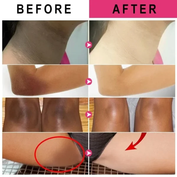 Loção Corporal Clareadora para Pele Escura Creme Hidratante para Mulheres Creme de Beleza para Mãos e Pele Creme Corporal Clareador para Cuidados com os Nódulos Cosméticos Coreanos - Imagem 4