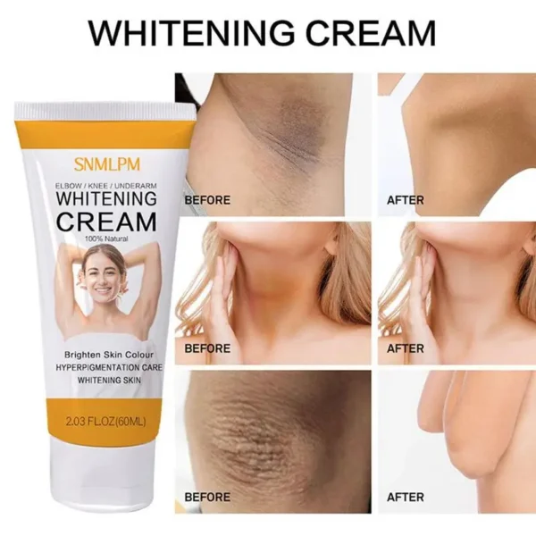 Creme Clareador para Pele Negra, Clareamento de Axilas, Áreas Íntimas, Axilas, Cuidado Corporal, Partes Particulares, Beleza, Saúde - Imagem 4