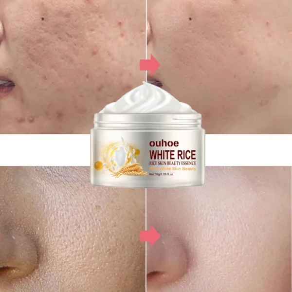Creme facial antirrugas de arroz, tratamento para acne e melasma, pigmentação, clareamento, lifting facial, beleza, hidratante, cosméticos coreanos, 30g - Imagem 2