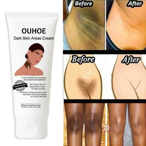 Loção Corporal Clareadora para Pele Escura Creme Hidratante para Mulheres Creme de Beleza para Mãos e Pele Creme Corporal Clareador para Cuidados com os Nódulos Cosméticos Coreanos - Imagem 2