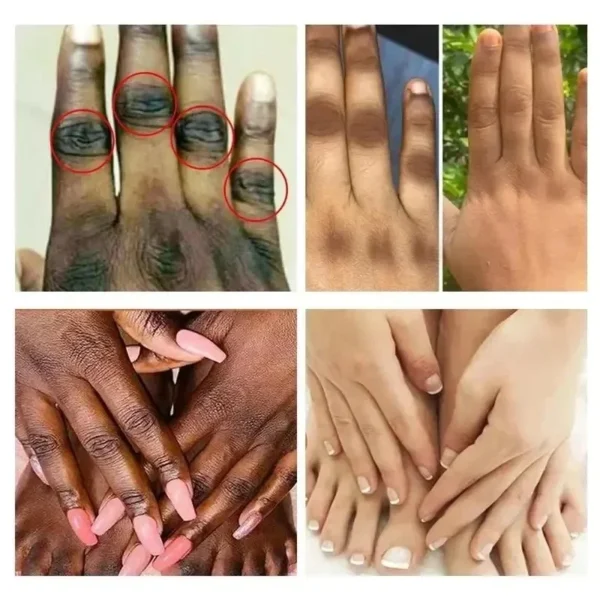 Loção Corporal Clareadora para Pele Escura Creme Hidratante para Mulheres Creme de Beleza para Mãos e Pele Creme Corporal Clareador para Cuidados com os Nódulos Cosméticos Coreanos - Imagem 5