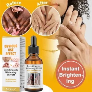 Dark Knuckles Fast Whitening Serum Mão Knuckle Cotovelos Joelho Corretor de Melanina Removedor de Manchas Intensas Produtos Cuidados de Beleza 30ml