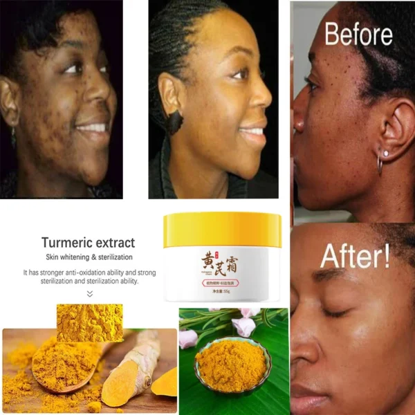 Creme facial clareador para remoção de sardas, melasma, corretivo para manchas escuras, clareia a pigmentação da melanina, clareia, antienvelhecimento, cuidados de beleza - Imagem 3