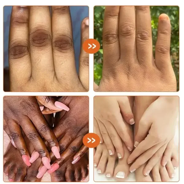 Dark Knuckles Fast Whitening Serum Mão Knuckle Cotovelos Joelho Corretor de Melanina Removedor de Manchas Intensas Produtos Cuidados de Beleza 30ml - Imagem 2