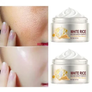 Creme facial antirrugas de arroz, tratamento para acne e melasma, pigmentação, clareamento, lifting facial, beleza, hidratante, cosméticos coreanos, 30g