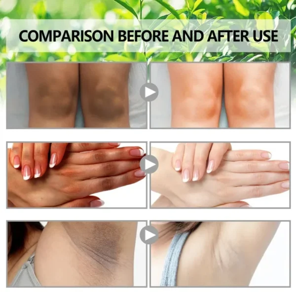 Loção Corporal Clareadora para Pele Escura Creme Hidratante para Mulheres Creme de Beleza para Mãos e Pele Creme Corporal Clareador para Cuidados com os Nódulos Cosméticos Coreanos - Imagem 3
