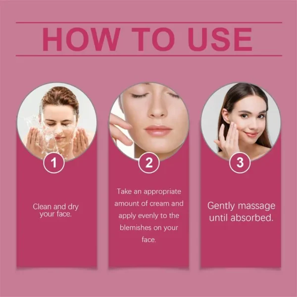 Creme facial clareador para remoção de sardas, melasma, corretivo para manchas escuras, clareia a pigmentação da melanina, clareia, antienvelhecimento, cuidados de beleza - Imagem 6