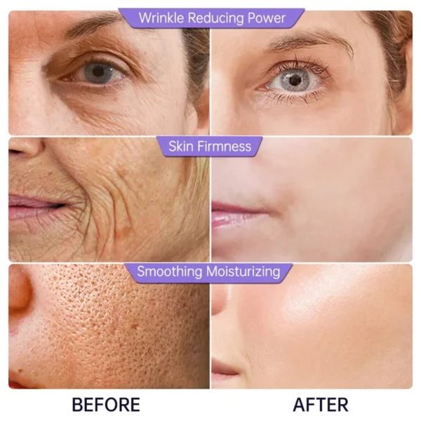 Colágeno Soro Facial Remoção de Rugas Antienvelhecimento Ácido Hialurônico Testa Facial Linhas Finas Lifting Serum Cuidados com a Pele Beleza 40ml - Imagem 3