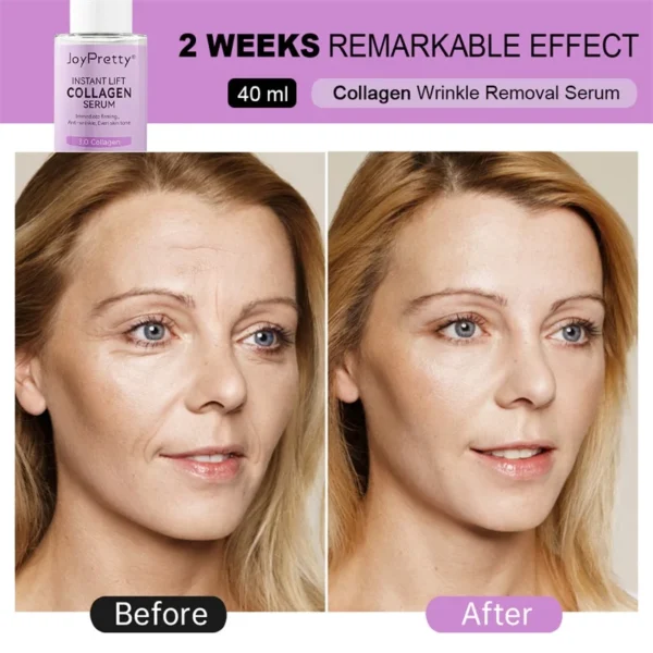Colágeno Soro Facial Remoção de Rugas Antienvelhecimento Ácido Hialurônico Testa Facial Linhas Finas Lifting Serum Cuidados com a Pele Beleza 40ml - Imagem 5