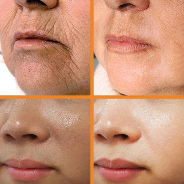 Cúrcuma Retinol Beauty Stick Creme Facial Clareador Melanina Hidratante Lifting de Rugas Rejuvenescedor Clareamento da Pele Cosméticos Coreanos - Imagem 2