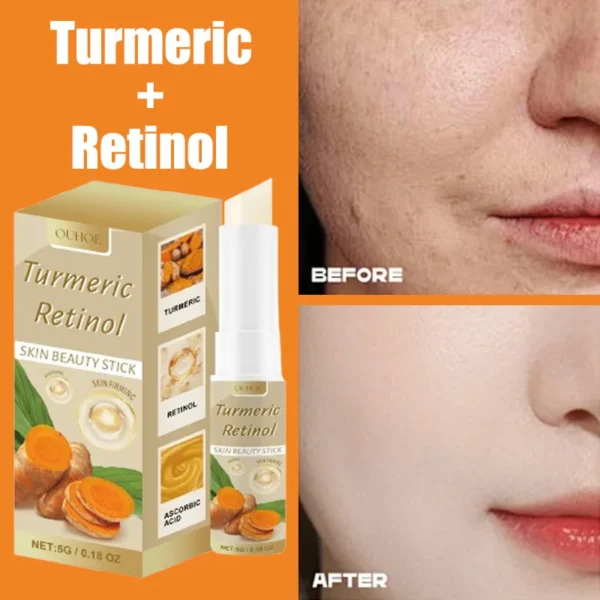 Cúrcuma Retinol Beauty Stick Creme Facial Clareador Melanina Hidratante Lifting de Rugas Rejuvenescedor Clareamento da Pele Cosméticos Coreanos - Imagem 3