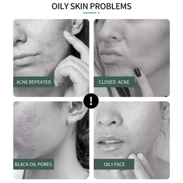 Ácido salicílico Clareador Encolher Creme Facial Suavizante Reparador Cremes para a Pele Facial Saúde Feminina Beleza Produtos para Cuidados com a Pele - Imagem 6